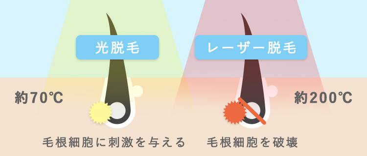 脱毛の痛みが不安な方へ 最近の脱毛は痛くない その理由を解説 脱毛love